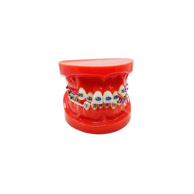 Typodont Teeth With Braces